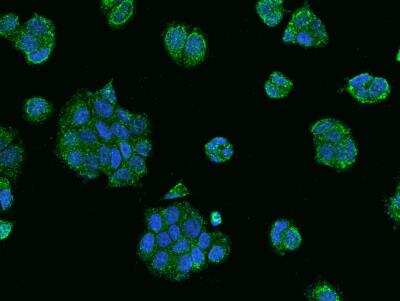 Immunocytochemistry/Immunofluorescence: RABEP2 Antibody [NBP3-06404] - Immunofluorescence staining of RABEP2 in MCF7 cells. Cells were fixed with 4% PFA, permeabilzed with 0.1% Triton X-100 in PBS,blocked with 10% serum, and incubated with rabbit anti-Human RABEP2 polyclonal antibody (dilution ratio 1:200) at 4 degrees celsius overnight. Then cells were stained with the Alexa Fluor (TM) 488-conjugated Goat Anti-rabbit IgG secondary antibody (green) and counterstained with DAPI (blue).Positive staining was localized to Cytoplasm.