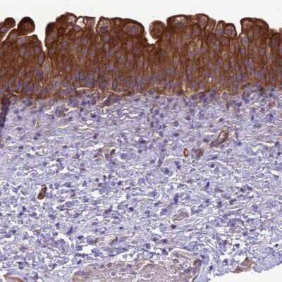 Immunohistochemistry-Paraffin: RABEP2 Antibody [NBP2-13195] - Staining of human urinary bladder shows strong cytoplasmic positivity in urothelial cells.