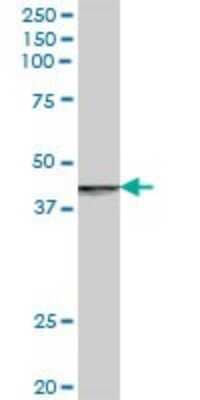 Western Blot: RABEP2 Antibody [H00079874-B01P] - Analysis of RABEP2 expression in human pancreas.