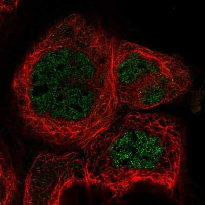Immunocytochemistry/Immunofluorescence: RABGGTA Antibody [NBP1-87197] - Immunofluorescent staining of human cell line A-431 shows localization to nucleoplasm.