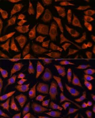 Immunocytochemistry/Immunofluorescence: RABGGTA Antibody [NBP2-94048] - Analysis of L929 cells using RABGGTA at dilution of 1:100. Blue: DAPI for nuclear staining.
