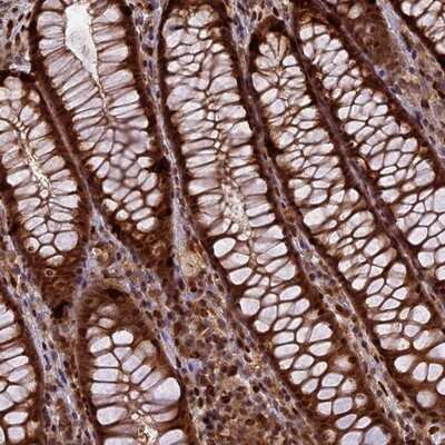 Immunohistochemistry-Paraffin: RABGGTA Antibody [NBP1-87197] - Staining of human rectum shows strong cytoplasmic and nuclear positivity in glandular cells.