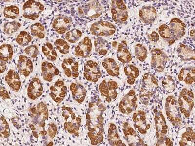Immunohistochemistry-Paraffin: RABGGTA Antibody [NBP2-97779] - Immunochemical staining of human RABGGTA in human stomach with rabbit polyclonal antibody at 1:100 dilution, formalin-fixed paraffin embedded sections.