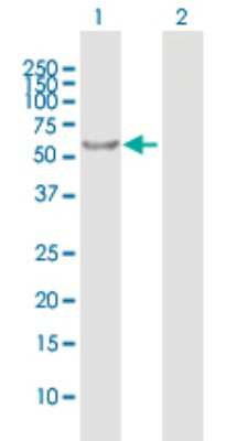 Western Blot: RABGGTA Antibody [H00005875-B01P] - Analysis of RABGGTA expression in transfected 293T cell line by RABGGTA polyclonal antibody.  Lane 1: RABGGTA transfected lysate(62.37 KDa). Lane 2: Non-transfected lysate.