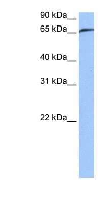Western Blot: RABGGTA Antibody [NBP1-55183] - Jurkat cell lysate, concentration 0.2-1 ug/ml.