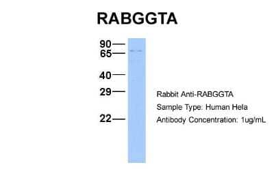 Western Blot: RABGGTA Antibody [NBP1-55183] - Hela, Antibody Dilution: 1.0 ug/ml RABGGTA is supported by BioGPS gene expression data to be expressed in HeLa.