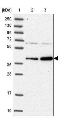 Western Blot RABGGTA Antibody - BSA Free