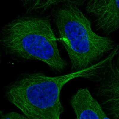 Immunocytochemistry/ Immunofluorescence RABIF/MSS4 Antibody - BSA Free