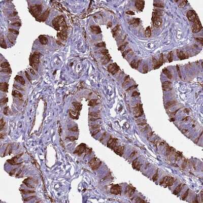 Immunohistochemistry-Paraffin: RABL2A Antibody [NBP2-46681] - Staining of human fallopian tube shows strong cytoplasmic positivity in glandular cells.