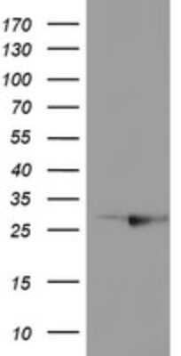 Western Blot: RABL2A Antibody (OTI4A3) - Azide and BSA Free [NBP2-73777] - Analysis of HEK293T cells were transfected with the pCMV6-ENTRY control (Left lane) or pCMV6-ENTRY RABL2A.