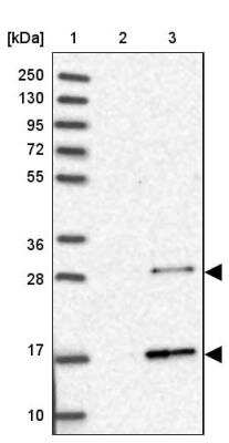 Western Blot: RABL2A Antibody [NBP2-46696] - Lane 1: Marker  [kDa] 250, 130, 95, 72, 55, 36, 28, 17, 10.  Lane 2: Human cell line RT-4.  Lane 3: Human cell line U-251 MG