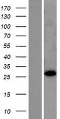 Western Blot RABL2B Overexpression Lysate