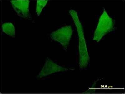 Immunocytochemistry/Immunofluorescence: RAC2 Antibody (3B8) [H00005880-M08] - Analysis of monoclonal antibody to RAC2 on HeLa cell. Antibody concentration 10 ug/ml