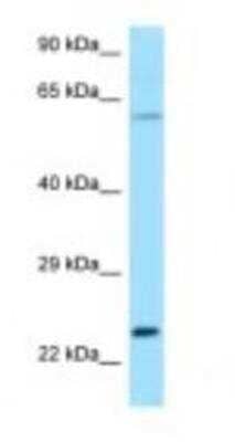 Western Blot: RAC2 Antibody [NBP1-98473] - Mouse Heart Lysate 1.0ug/ml, Gel Concentration: 12%