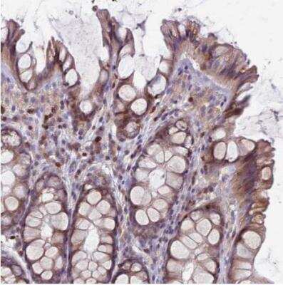 Immunohistochemistry-Paraffin: RAC3 Antibody [NBP2-32058] - Staining of human colon shows weak to moderate membranous/cytoplasmic positivity in glandular cells.