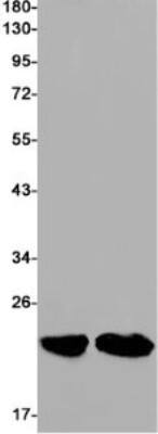 Western Blot: RAC3 Antibody (S01-6I8) [NBP3-19756] - Western blot detection of RAC3 in K562 (Lane 1), Rat Brain (Lane 2) cell lysates using NBP3-19756 (1:1000 diluted). Predicted band size: 21kDa. Observed band size: 21kDa.