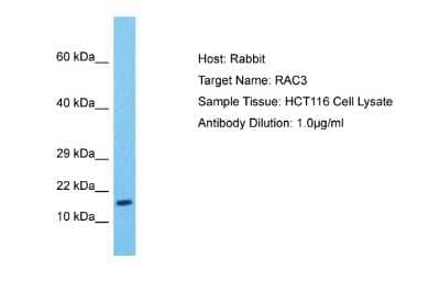 Western Blot: RAC3 Antibody [NBP2-85583] - Host: Rabbit. Target Name: RAC3. Sample Type: HCT116 Whole Cell. Antibody Dilution: 1.0ug/ml