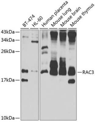 Western Blot: RAC3 Antibody [NBP3-04493] - Analysis of extracts of various cell lines, using RAC3 antibody at 1:1000 dilution. Secondary antibody: HRP Goat Anti-Rabbit IgG (H+L) at 1:10000 dilution. Lysates/proteins: 25ug per lane. Blocking buffer: 3% nonfat dry milk in TBST. Detection: ECL Enhanc