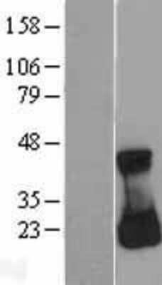 Western Blot: RAC3 Overexpression Lysate (Adult Normal) [NBL1-15107] Left-Empty vector transfected control cell lysate (HEK293 cell lysate); Right -Over-expression Lysate for RAC3.