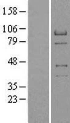 Western Blot: RACGAP1 Overexpression Lysate (Adult Normal) [NBP2-09419] Left-Empty vector transfected control cell lysate (HEK293 cell lysate); Right -Over-expression Lysate for RACGAP1.