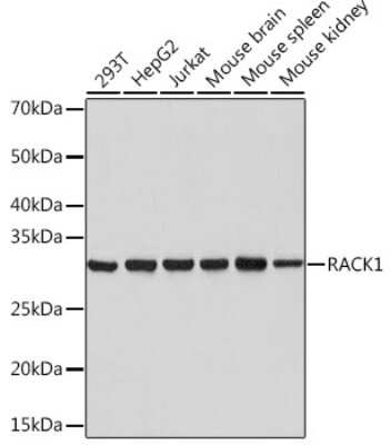 Western Blot: RACK1/GNB2L1 Antibody (7B6J4) [NBP3-16277] - Western blot analysis of extracts of various cell lines, using RACK1/GNB2L1 Rabbit mAb (NBP3-16277) at 1:1000 dilution. Secondary antibody: HRP Goat Anti-Rabbit IgG (H+L) at 1:10000 dilution. Lysates/proteins: 25ug per lane. Blocking buffer: 3% nonfat dry milk in TBST. Detection: ECL Basic Kit. Exposure time: 1s.