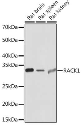 Western Blot: RACK1/GNB2L1 Antibody (7B6J4) [NBP3-16277] - Western blot analysis of extracts of various cell lines, using RACK1/GNB2L1 Rabbit mAb (NBP3-16277) at 1:1000 dilution. Secondary antibody: HRP Goat Anti-Rabbit IgG (H+L) at 1:10000 dilution. Lysates/proteins: 25ug per lane. Blocking buffer: 3% nonfat dry milk in TBST. Detection: ECL Basic Kit. Exposure time: 10s.