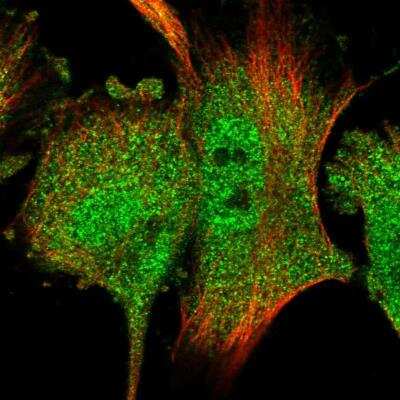 Immunocytochemistry/Immunofluorescence: RACK1/GNB2L1 Antibody [NBP1-83356] - Staining of human cell line U-251 MG shows localization to nucleoplasm & cytosol. Antibody staining is shown in green.