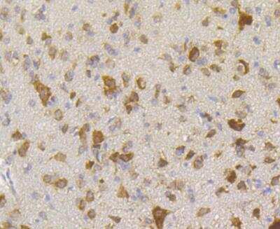 Immunohistochemistry: RACK1/GNB2L1 Antibody (JG40-26) [NBP2-76864] - Immunohistochemical analysis of paraffin-embedded rat cerebellum tissue using anti-RACK1 antibody. Counter stained with hematoxylin.