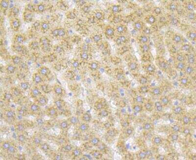 Immunohistochemistry: RACK1/GNB2L1 Antibody (JG40-26) [NBP2-76864] - Immunohistochemical analysis of paraffin-embedded rat liver tissue using anti-RACK1 antibody. Counter stained with hematoxylin.