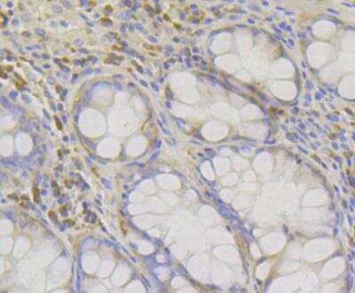 Immunohistochemistry: RACK1/GNB2L1 Antibody (JG40-26) [NBP2-76864] - Immunohistochemical analysis of paraffin-embedded human colon tissue using anti-RACK1 antibody. Counter stained with hematoxylin.