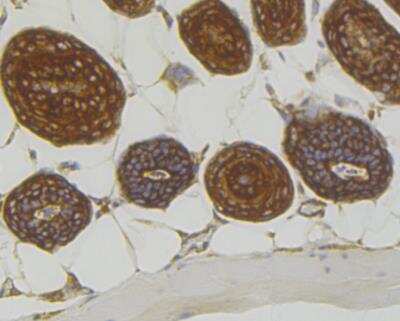Immunohistochemistry: RACK1/GNB2L1 Antibody (JG40-26) [NBP2-76864] - Immunohistochemical analysis of paraffin-embedded mouse skin tissue using anti-RACK1 antibody. Counter stained with hematoxylin.