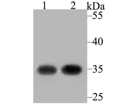Western Blot: RACK1/GNB2L1 Antibody (JG40-26) [NBP2-76864] - Western blot analysis of RACK1 on different lysates using anti-RACK1 antibody at 1/2,000 dilution.Positive control:Lane 1: SH-SY-5Y Lane 2: Rat small intestine