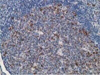 Immunohistochemistry: RACK1/GNB2L1 Antibody (OTI2D8) - Azide and BSA Free [NBP2-73781] - Staining of paraffin-embedded Human lymph node tissue using anti-GNB2L1 mouse monoclonal antibody.