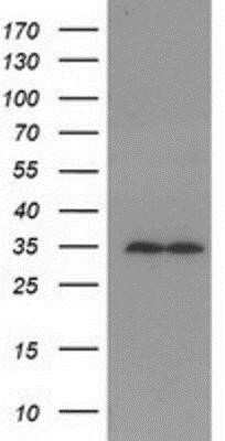 Western Blot: RACK1/GNB2L1 Antibody (OTI2D8) - Azide and BSA Free [NBP2-73781] - HEK293T cells were transfected with the pCMV6-ENTRY control (Left lane) or pCMV6-ENTRY GNB2L1 (Right lane) cDNA for 48 hrs and lysed. Equivalent amounts of cell lysates (5 ug per lane) were separated by SDS-PAGE and immunoblotted with anti-GNB2L1.