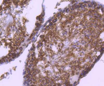 Immunohistochemistry-Paraffin: RAD18 Antibody (SN66-01) [NBP2-67669] - Analysis of paraffin-embedded rat testis tissue using anti-RAD18 antibody. Counter stained with hematoxylin.