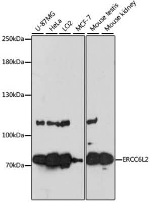 Western Blot: RAD26L Antibody [NBP2-94416] - Analysis of extracts of various cell lines, using RAD26L .Exposure time: 60s.