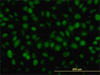 Immunocytochemistry/Immunofluorescence: RAD54B Antibody (4A7) [H00025788-M01] - Analysis of monoclonal antibody to RAD54B on HeLa cell. Antibody concentration 10 ug/ml.