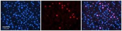 Immunohistochemistry-Paraffin: RAD54B Antibody [NBP1-58233] - Antibody   Formalin Fixed Paraffin Embedded Tissue: Human Adult Liver  Observed Staining: Nuclear in hepatocytes, very strong signal, wide tissue distribution