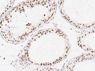 Immunohistochemistry-Paraffin: RAD54B Antibody [NBP2-99021] - Immunochemical staining of human RAD54B in human testis with rabbit polyclonal antibody (1:1000, formalin-fixed paraffin embedded sections).