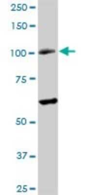 Western Blot: RAD54B Antibody [H00025788-D01P] - Analysis of RAD54B expression in human stomach.