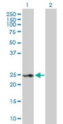 Western Blot: RAD54B Antibody [H00025788-D01P] - Analysis of RAD54B expression in transfected 293T cell line by RAD54B polyclonal antibody.Lane 1: RAD54B transfected lysate(18.60 KDa).Lane 2: Non-transfected lysate.