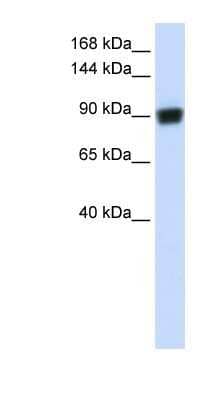 Western Blot: RAD54B Antibody [NBP1-58233] - Human Brain lysate, concentration 0.2-1 ug/ml.