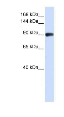 Western Blot: RAD54B Antibody [NBP1-58238] - Jurkat cell lysate, concentration 0.2-1 ug/ml.