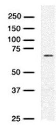 Western Blot: RAD54L Antibody (38.4) [NBP1-41218] - RAD54 Antibody (38.4) [NBP1-41218] - HeLa whole cell extract.