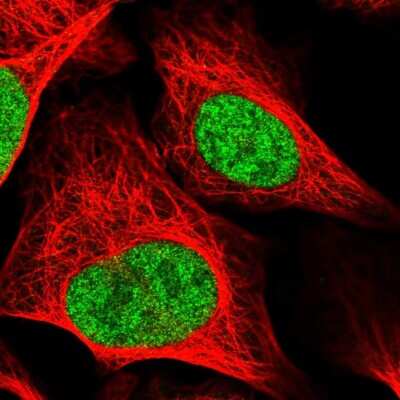 Immunocytochemistry/Immunofluorescence: RAD54L Antibody [NBP2-58260] - Staining of human cell line U-2 OS shows localization to nucleoplasm.
