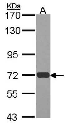 Western Blot: RAD54L Antibody [NBP1-31892] - Sample (30 ug of whole cell lysate) A: JurKat 7.5% SDS PAGE RAD54L antibody, antibody diluted at 1:1000.