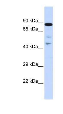 Western Blot: RAD54L Antibody [NBP1-58228] - Titration: 0.2-1 ug/ml, Positive Control: Human Placenta.