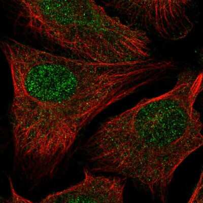 Immunocytochemistry/ Immunofluorescence RAD54L2 Antibody - BSA Free