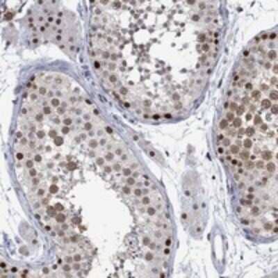 Immunohistochemistry-Paraffin: RAD54L2 Antibody [NBP3-17301] - Staining of human testis shows strong nuclear positivity in cells in seminiferous ducts and Leydig cells.
