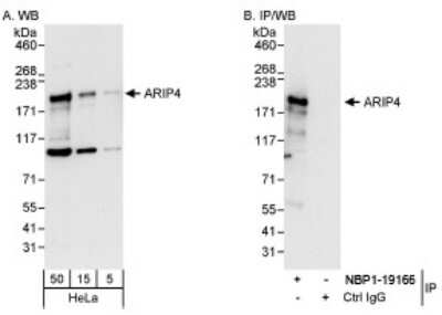 Western Blot RAD54L2 Antibody